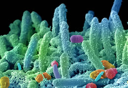 显微镜下的口腔细菌：细长如海洋植物