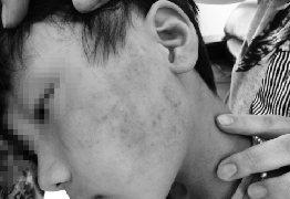 商水10岁女童向同学施暴 扇耳光挤肚子强迫舔脚趾